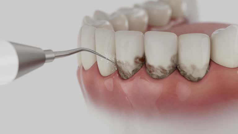 Reliable Root Canal Treatment contractor in Brunswick County County, NC by Dentist Open Now
